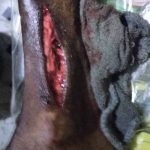 Build a Medical Center in Africa